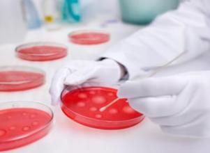 精子检查有哪几项?精子检查要如何取精